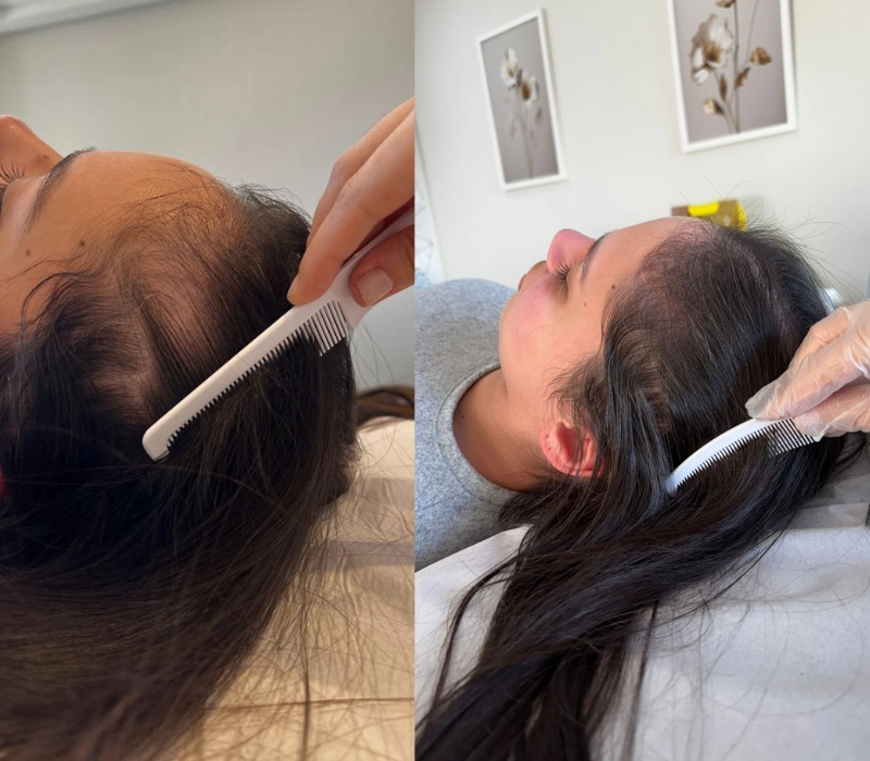 Clinica de tricologia - resultados