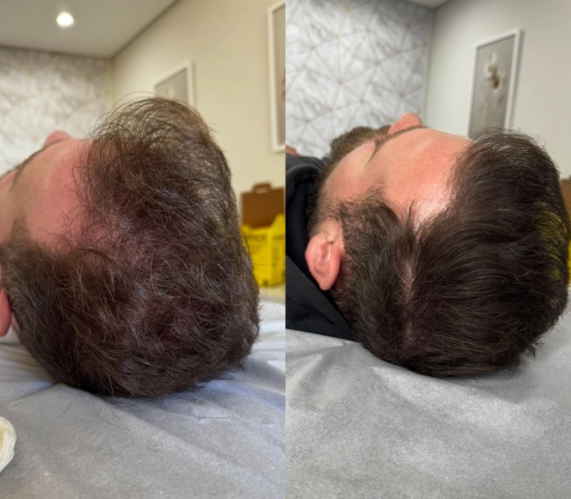 Clinica-de-tricologia-resultados