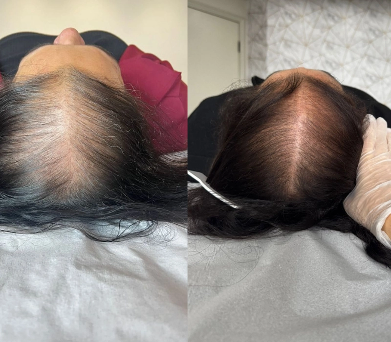 Clinica-de-tricologia-resultados